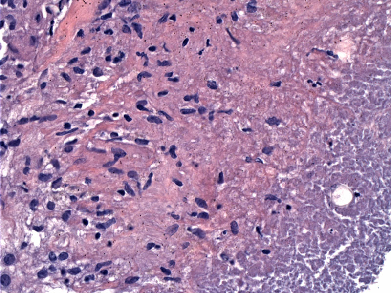 Pathology Image